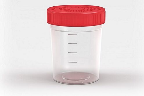 container voor het testen op parasieten