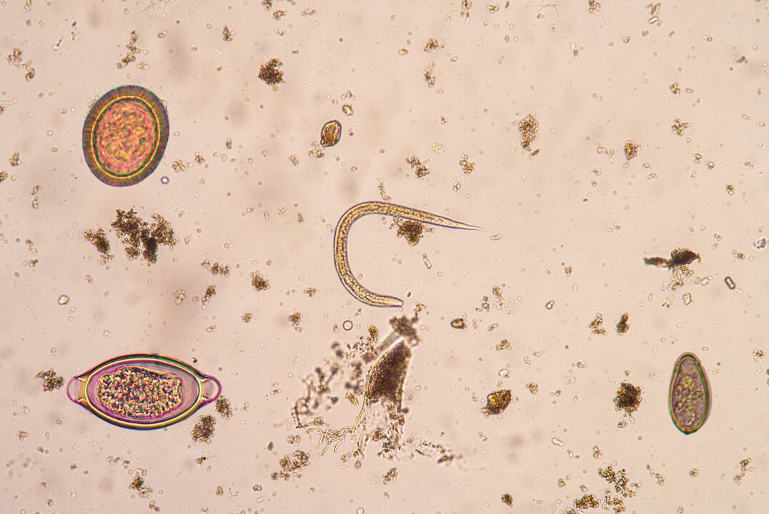 Larvale stadium van onderhuidse parasieten