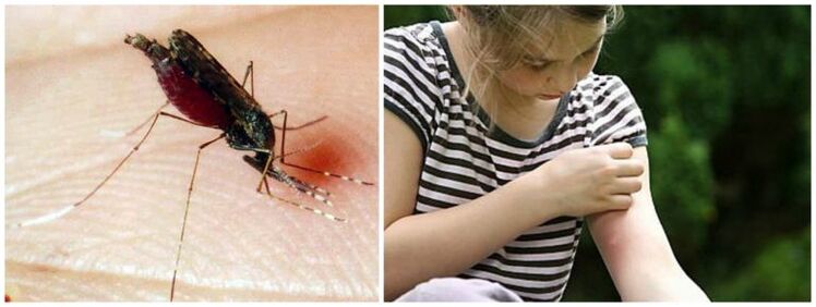 Pijnlijke knobbels na een muggenbeet kunnen een symptoom zijn van hartworm