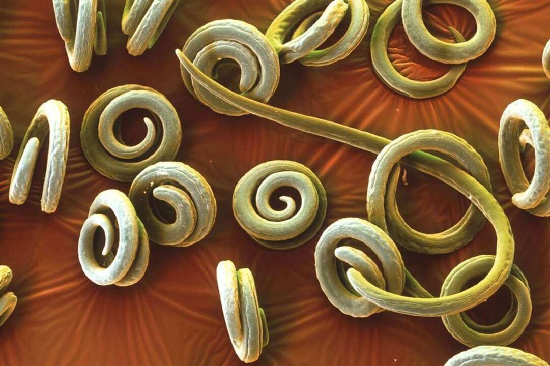 wormen parasieten uit het menselijk lichaam