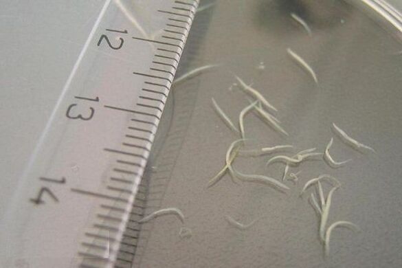 hoe zien pinworms eruit 