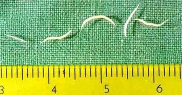 Pinworms zijn het meest voorkomende type worm bij jonge kinderen. 