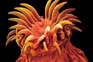 Trematodenparasieten bij mensen