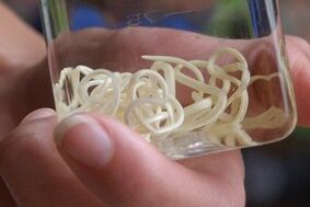 parasieten uit het menselijk lichaam